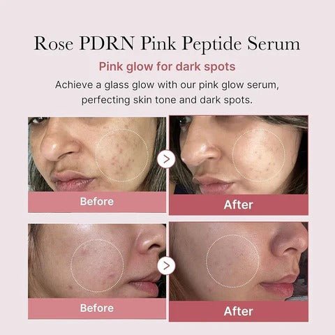 Medicube – PDRN Pink Peptide Serum – 30ml