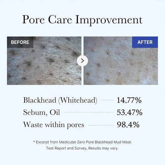 MEDICUBE – Zero Pore Blackhead Mud Mask – 100G