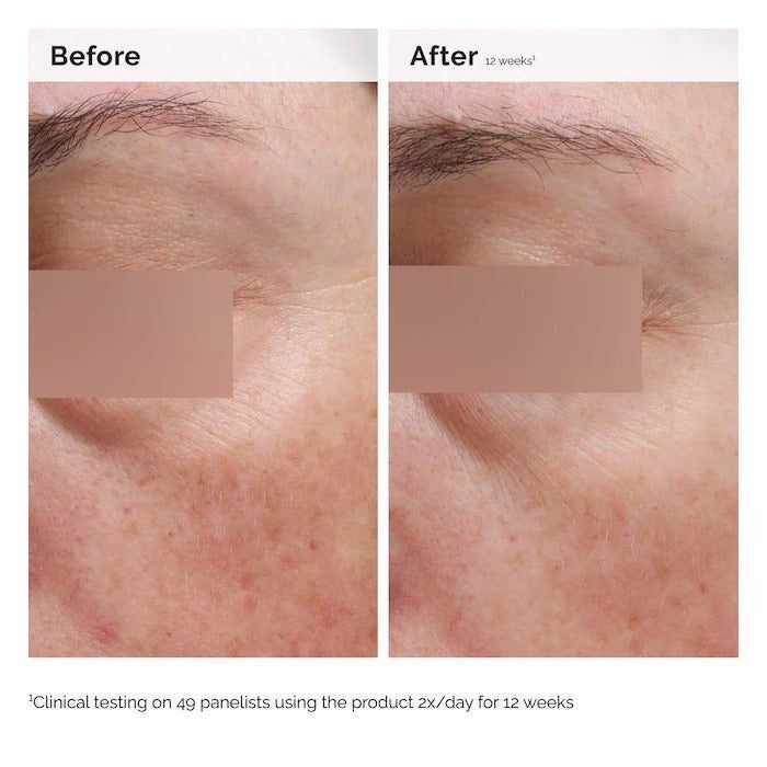 THE ORDINARY – Niacinamide 5% Face and Body Emulsion – 100ML