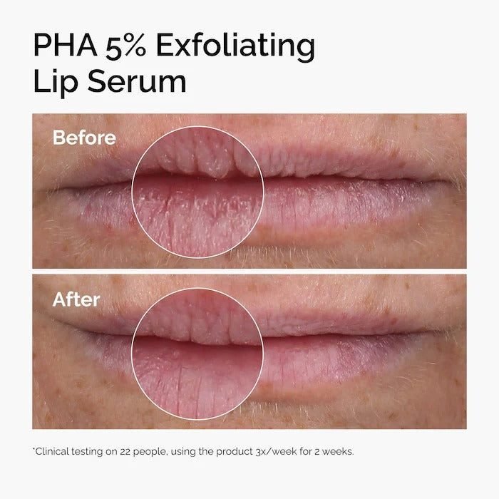 THE ORDINARY – PHA 5% Exfoliating Lip Serum – 15ML